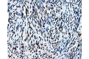 Immunohistochemical staining of paraffin-embedded Kidney tissue using anti-MCL1 mouse monoclonal antibody. (MCL-1 antibody)