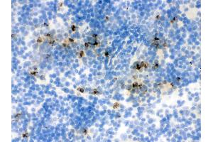 Immunohistochemistry (IHC) image for anti-Lipocalin 2 (LCN2) (AA 21-200) antibody (ABIN3043290)