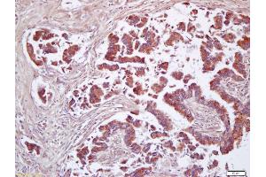 Immunohistochemistry (IHC) image for anti-CD200 (CD200) (AA 41-140) antibody (ABIN761396)