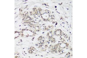 Immunohistochemistry of paraffin-embedded rat brain using NRF2 antibody (ABIN6130584, ABIN6144560, ABIN6144562 and ABIN6213925) at dilution of 1:100 (40x lens). (NRF2 antibody  (AA 366-605))