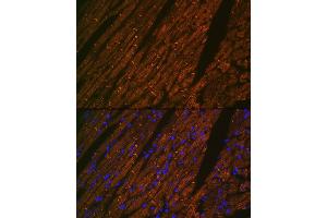 Immunofluorescence analysis of rat heart using Desmin Rabbit mAb (ABIN1678733, ABIN3018020, ABIN3018021 and ABIN7101569) at dilution of 1:100 (40x lens). (Desmin antibody)
