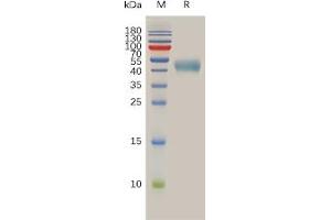 Human S Protein, hFc Tag on SDS-PAGE under reducing condition. (SSTR2 Protein (AA 1-43) (Fc Tag))