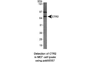 Image no. 1 for anti-Solute Carrier Family 31 (Copper Transporters), Member 2 (SLC31A2) (AA 50-100) antibody (ABIN363666) (SLC31A2 antibody  (AA 50-100))