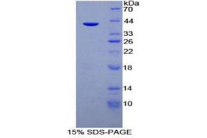 SDS-PAGE (SDS) image for Mucin 6, Oligomeric Mucus/gel-Forming (MUC6) (AA 2338-2439) protein (His tag,GST tag) (ABIN1525525)