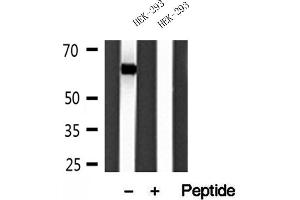 Western blot analysis of extracts of HEK-293 cells, using Sestrin 2 antibody. (Sestrin 2 antibody)