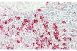 Detection of CFD in Human Spleen Tissue using Polyclonal Antibody to Complement Factor D (CFD) (Adipsin antibody  (AA 1-253))