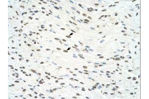 Image no. 2 for anti-Interleukin enhancer-binding factor 3 (ILF3) (AA 23-72) antibody (ABIN6736293) (Interleukin enhancer-binding factor 3 (ILF3) (AA 23-72) antibody)