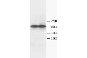 Western Blotting (WB) image for anti-Tyrosine Hydroxylase (TH) antibody (ABIN1109422) (Tyrosine Hydroxylase antibody)