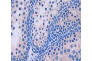 Used in DAB staining on fromalin fixed paraffin- embedded Kidney tissue (GGPS1 antibody  (AA 78-258))