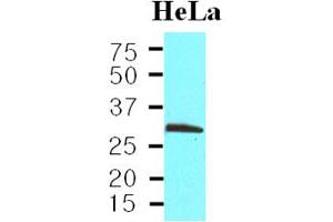 Western Blotting (WB) image for anti-Proliferating Cell Nuclear Antigen (PCNA) (AA 1-261), (N-Term) antibody (ABIN302209)