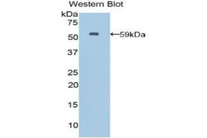 Detection of Recombinant MSN, Human using Polyclonal Antibody to Moesin (MSN) (Moesin antibody  (AA 354-577))