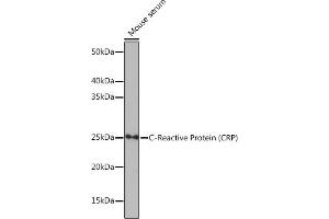 Western blot analysis of extracts of Mouse serum, using C-Reactive Protein (C-Reactive Protein (CRP)) antibody (ABIN7265972) at 1:1000 dilution. (CRP antibody)