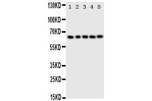 Anti-p63 antibody, Western blotting Lane 1: HELA Cell Lysate Lane 2: SMMC Cell Lysate Lane 3: COLO320 Cell Lysate Lane 4: A549 Cell Lysate Lane 5: SGC Cell Lysate (p63 antibody  (C-Term))