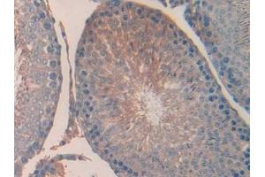 Detection of UCN in Rat Testis Tissue using Polyclonal Antibody to Urocortin (UCN) (Urocortin antibody  (AA 31-121))