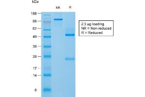 SDS-PAGE Analysis Purified Filaggrin Rabbit Recombinant Monoclonal Antibody (FLG/1957R). (Recombinant Filaggrin antibody  (AA 198-288))