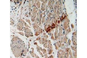 Used in DAB staining on fromalin fixed paraffin- embedded esophagus cancer tissue (FOXO1 antibody  (AA 333-557))