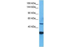 WB Suggested Anti-ZSC29 antibody Titration: 1 ug/mL Sample Type: Human RPMI-8226 Whole Cell (ZSCAN29 antibody  (Middle Region))