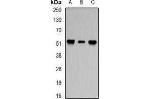 Western blot analysis of PPP2R2A expression in Hela (A), Jurkat (B), mouse brain (C) whole cell lysates. (PPP2R2A antibody)
