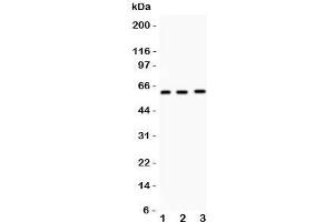 Western blot testing of FMO5 antibody and mouse samples (50ug/lane) 1: liver;  2: testis;  3: spleen tissue lysate. (FMO5 antibody  (N-Term))
