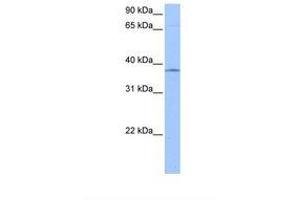 Image no. 1 for anti-Sprouty Homolog 2 (SPRY2) (N-Term) antibody (ABIN6738714) (SPRY2 antibody  (N-Term))