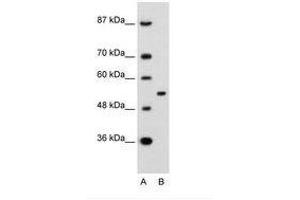 Image no. 2 for anti-Amyloid beta (A4) Precursor Protein-Binding, Family A, Member 1 (APBA1) (AA 41-90) antibody (ABIN6736687)