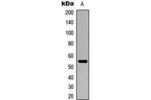 Western blot analysis of ALDH1A2 expression in MCF7 (A) whole cell lysates. (ALDH1A2 antibody  (C-Term))