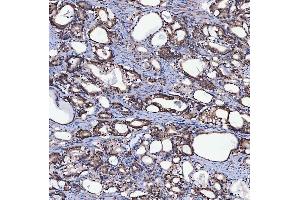 IHC analysis of SH2D4A using anti-SH2D4A antibody (ABIN7601695). (SH2D4A antibody  (AA 42-454))
