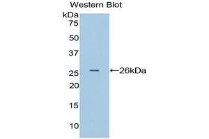 Detection of Recombinant APC, Rat using Polyclonal Antibody to Adenomatosis Polyposis Coli Protein (APC) (APC antibody  (AA 2634-2842))