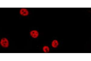 ABIN6267063 staining Hela by IF/ICC. (Histone H4 antibody  (acLys12))