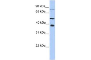 Western Blotting (WB) image for anti-Methyltransferase Like 2B (METTL2B) antibody (ABIN2463220) (METTL2B antibody)