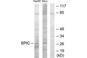 Western blot analysis of extracts from HepG2/HeLa cells, using SPIC Antibody.