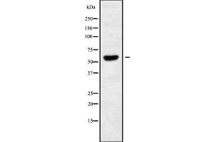 Western blot analysis of TIGD2 using K562 whole cell lysates (TIGD2 antibody)