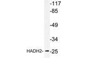Western blot analysis of HADH2 antibody in extracts from LOVO cells.