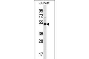 FA8A1 Antibody (N-term) (ABIN656718 and ABIN2845946) western blot analysis in Jurkat cell line lysates (35 μg/lane). (FAM8A1 antibody  (N-Term))