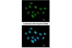ICC/IF Image Immunofluorescence analysis of paraformaldehyde-fixed A431, using XPC, antibody at 1:500 dilution. (XPC antibody  (C-Term))