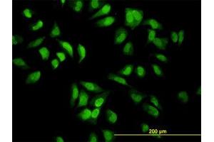 Image no. 1 for anti-Eukaryotic Translation Initiation Factor 2-alpha Kinase 2 (EIF2AK2) (AA 1-101) antibody (ABIN598900) (EIF2AK2 antibody  (AA 1-101))