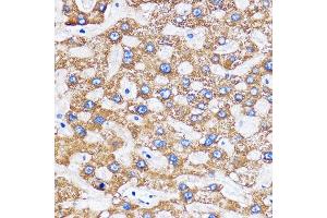 Immunohistochemistry of paraffin-embedded Human liver using MITD1 Rabbit pAb (ABIN7268548) at dilution of 1:100 (40x lens). (MITD1 antibody)