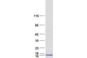Western Blotting (WB) image for Acrosomal Vesicle Protein 1 (ACRV1) (Transcript Variant 10) protein (Myc-DYKDDDDK Tag) (ABIN2714341)