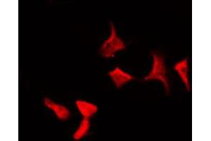 ABIN6267589 staining HepG2 by IF/ICC. (RELB antibody  (pSer573))