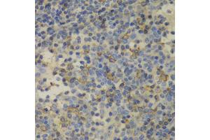 Immunohistochemistry of paraffin-embedded human amygdalitis using FTL antibody (ABIN5970889) at dilution of 1/100 (40x lens). (FTL antibody)