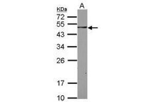 Image no. 2 for anti-SH3-Domain Binding Protein 5 (SH3BP5) (AA 108-455) antibody (ABIN1500916)