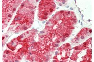 Rabbit Anti-KHK antibody  Formalin Fixed Paraffin Embedded Tissue: Human Kidney Primary antibody Concentration: 1:100 Secondary Antibody: Donkey anti-Rabbit-Cy3 Secondary Antibody Concentration: 1:200 Magnification: 20x Exposure Time: 0. (Ketohexokinase antibody  (N-Term))