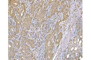 IHC analysis of SND1 using anti-SND1 antibody (ABIN7600525).