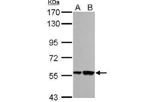 WB Image RBMY1A1 antibody detects RBMY1A1 protein by Western blot analysis.