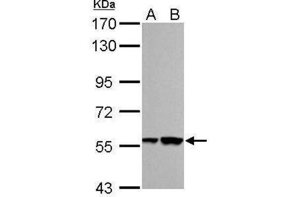 RBMY1A1 Antikörper