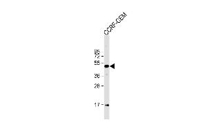 Anti-MYCN Antibody (C-term) at 1:1000 dilution + CCRF-CEM whole cell lysate Lysates/proteins at 20 μg per lane. (MYCN antibody  (C-Term))