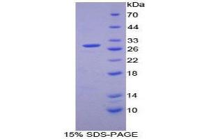 SDS-PAGE (SDS) image for Cyclin D2 (CCND2) (AA 68-278) protein (His tag) (ABIN2124522) (Cyclin D2 Protein (CCND2) (AA 68-278) (His tag))