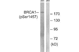 Western blot analysis of extracts from 293 cells, treated with epo (20U/ml, 15mins), using BRCA1 (Phospho-Ser1457) antibody. (BRCA1 antibody  (pSer1457))
