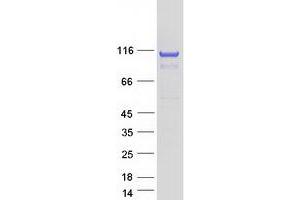 Validation with Western Blot (alpha KGDHC Protein (Transcript Variant 1) (Myc-DYKDDDDK Tag))