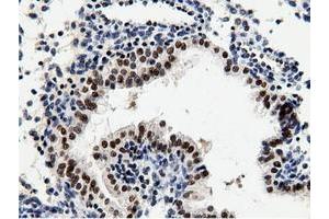 Image no. 2 for anti-5'-Nucleotidase Domain Containing 1 (NT5DC1) antibody (ABIN1499838) (NT5DC1 antibody)